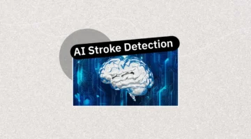 أداة ذكية ترصد الجلطات الدماغية مبكرًا باستخدام صور الأشعة المقطعية للمرضى